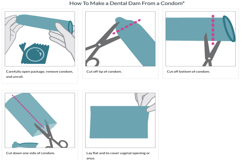 Dental Dam